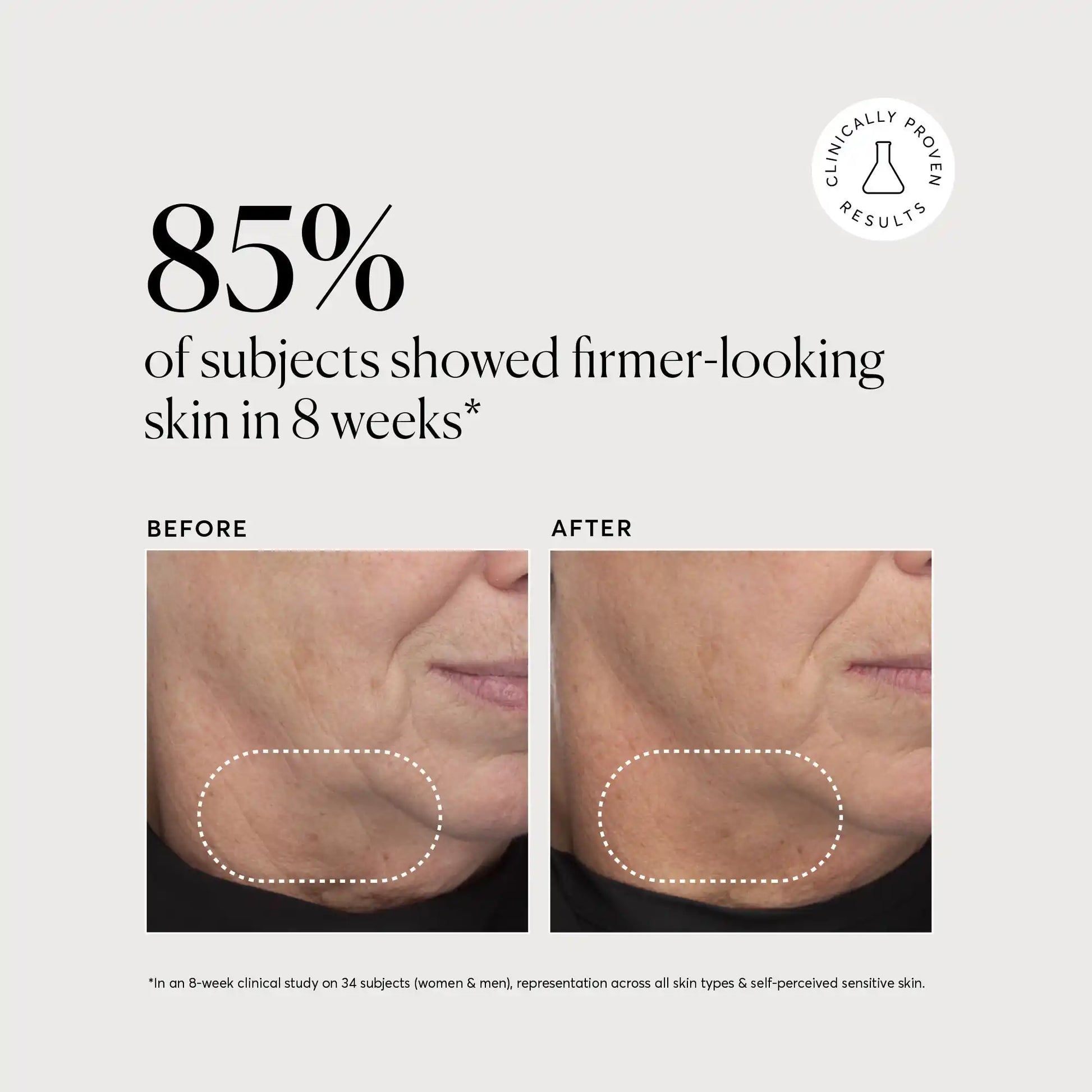 retinol-complex-serum-s4 NATR-10034-Alt-Images-Retinol-Complex-Serum-04.webp